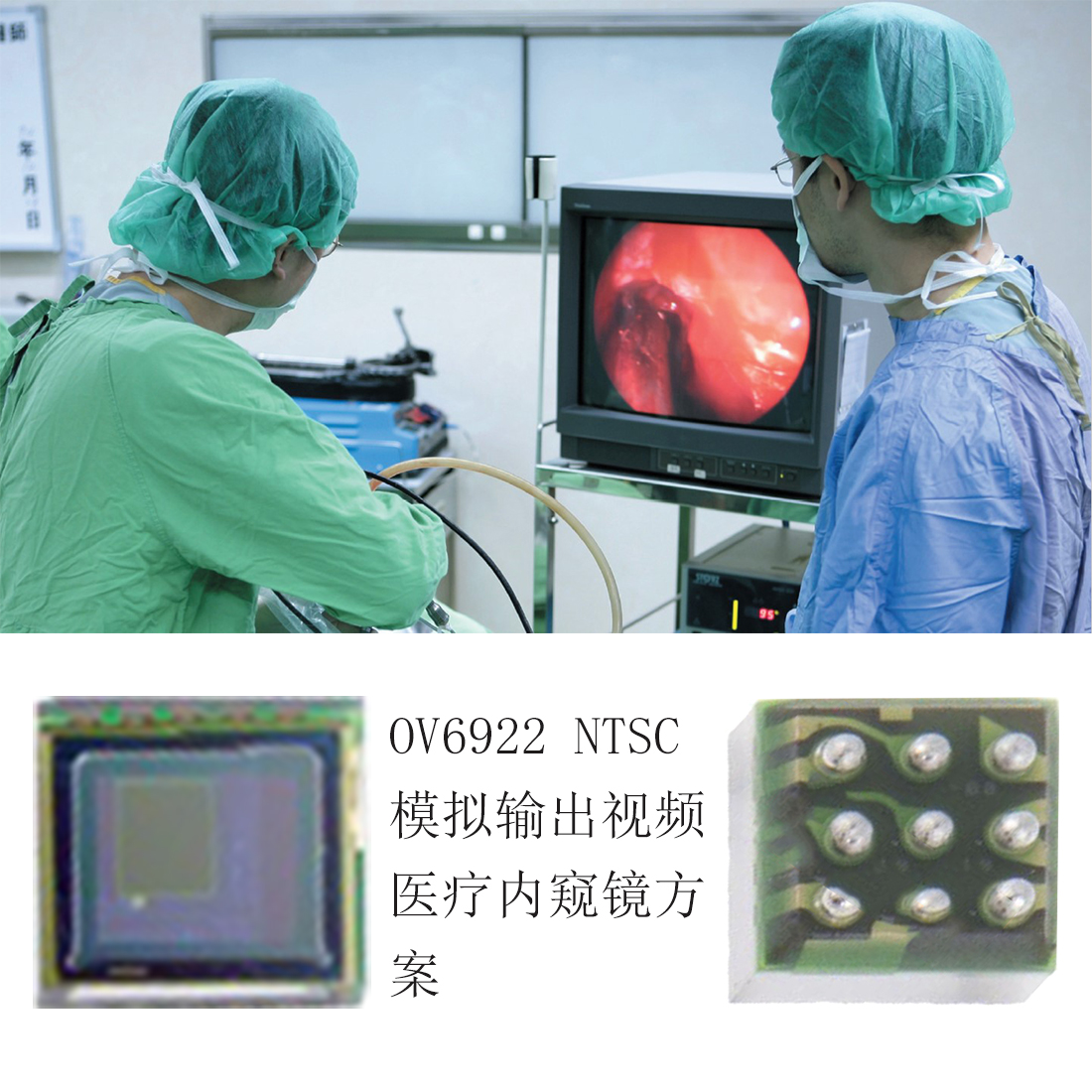 OV06922内窥镜芯片，医疗内窥镜图像传感器，内窥镜sensor，超小型图像传感器，医用模拟图像传感器，医疗内窥镜感光芯片，OV内窥镜芯片，医用传感器，医疗用品传感器，医用摄像头芯片，超小型内窥镜芯片，医用摄像头图像传感器，肠镜胃镜阴道镜芯片，Endoscope image sensor，Medical camera chip, 1/18" CMOS Sensor, micro camera sensor，1/18-inch sensor  